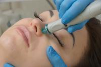 Nouveauté chez Superfit institut : Hydradermabrasion. Le soin qui va tout changer